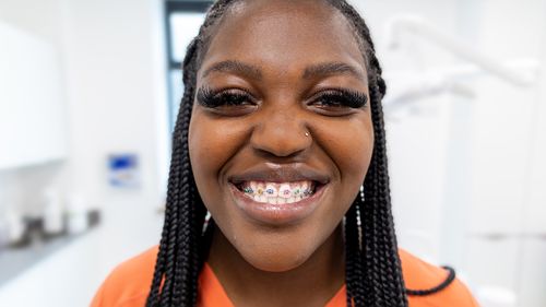 coloured braces - dr sandra montano - 3Dental